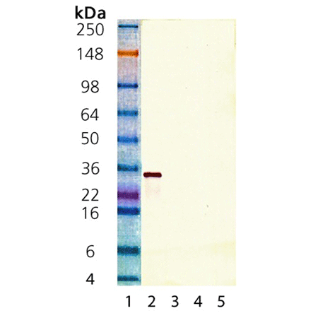 SIRT5 polyclonal antibody Western blot