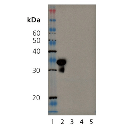 SIRT5 polyclonal antibody Western blot