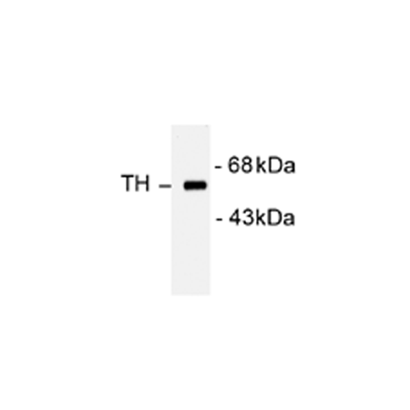 Tyrosine hydroxylase polyclonal antibody Western blot