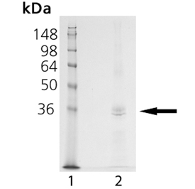 ADAM17 (catalytic domain) (human), (recombinant) (His-tag) SDS-PAGE