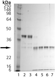 Cathepsin K (human), (recombinant) Activation