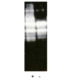 Hdm2 (catalytic RING domain) (human), (recombinant) (GST-tag) Western blot