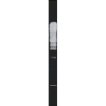 ([K11-only]Ub)n-ubiquitinylated substrate Western blot