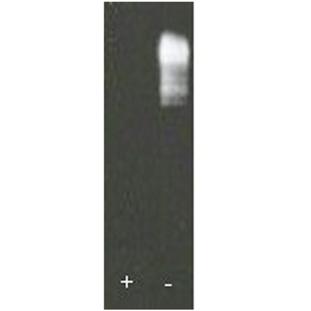([K48-only]Ub)n-ubiquitinylated substrate Western blot