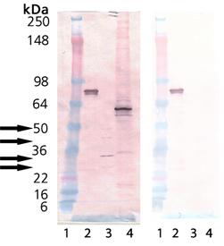 Proteasome 19S Rpn10/S5a subunit (human), (recombinant) (GST-tag) Western blot