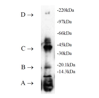 UbcH2 (human), (recombinant) (His-tag) SDS-PAGE