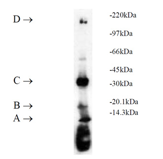 UbcH7 (human), (recombinant) (His-tag) SDS-PAGE