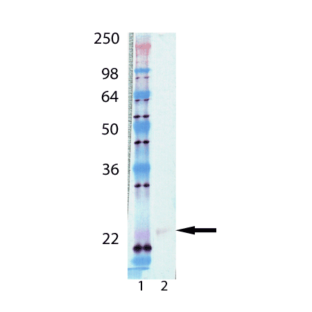 UbcH12 (human), (recombinant) (His-tag) Western blot