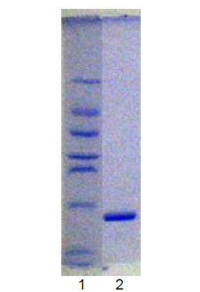 Ubc9 (human), (recombinant) (untagged) SDS-PAGE