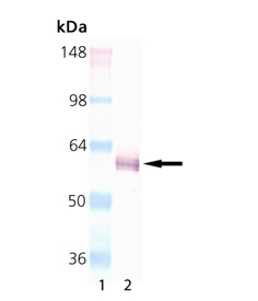 USP14 (human), (recombinant) (untagged) Western blot