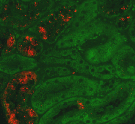 NGAL (mouse) monoclonal antibody (29) Immunohistochemistry