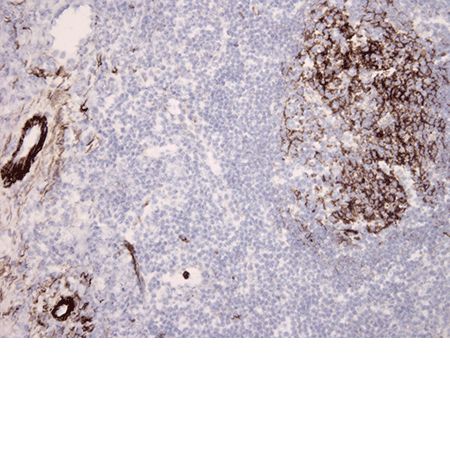 Complement component C5b-9 monoclonal antibody (aE11) Immunohistochemistry