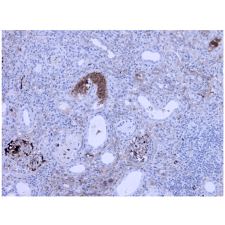 Complement component C3a/C3a (desArg) monoclonal antibody (K13/16) Immunohistochemistry