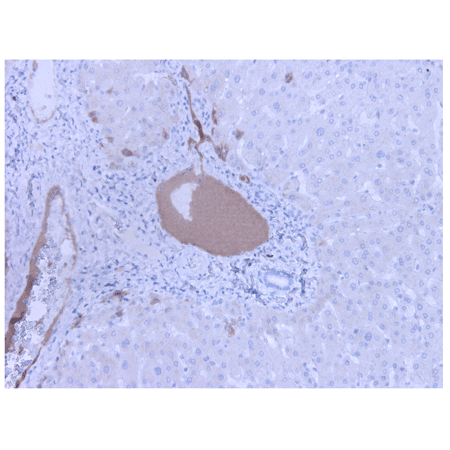 Complement component C3a/C3a (desArg) monoclonal antibody (K13/16) Immunohistochemistry