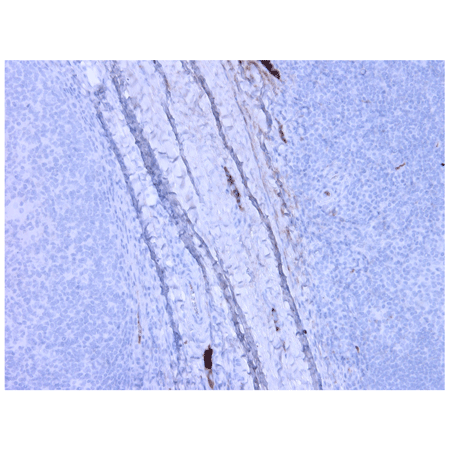 Complement component C3a/C3a (desArg) monoclonal antibody (K13/16) Immunohistochemistry