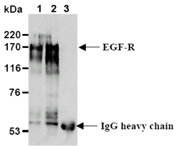 EGF receptor monoclonal antibody (6F1) Immunoprecipitation
