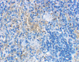 MD-2 polyclonal antibody Immunohistochemistry