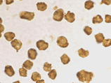 SARM polyclonal antibody Immunocytochemistry