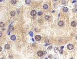 ST2 polyclonal antibody Immunohistochemistry