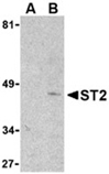 ST2 polyclonal antibody Western blot