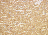 TIRAP polyclonal antibody Immunohistochemistry
