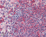 TNF receptor 1 polyclonal antibody Immunohistochemistry