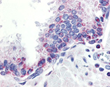 APRIL polyclonal antibody Immunohistochemistry