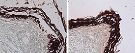 Cytokeratin 1/5/10/14 (human) monoclonal antibody (34βE12) (Ready-to-Use) Immunohistochemistry