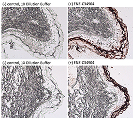 Cytokeratin 1 (human) monoclonal antibody (34βB4) (Ready-to-Use) Immunohistochemistry