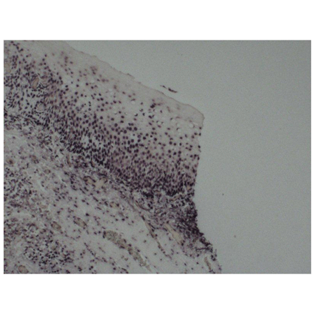 BIO-PROBE® Blur 8 probe IHS