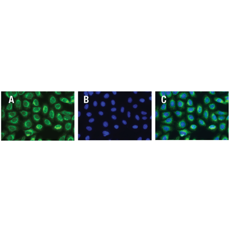 ER-ID® Green assay kit Fig2-web