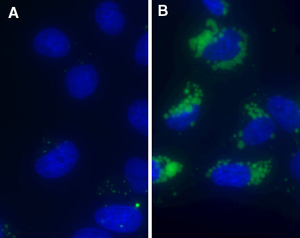 LYSO-ID® Green detection kit microscopy_resized