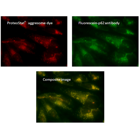 PROTEOSTAT® Aggresome detection kit 02