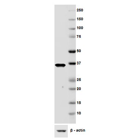 Lymphatic endothelial marker (human) monoclonal antibody (D2-40) Western Blot