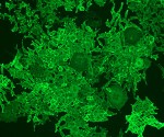 CD40 (human) monoclonal antibody (G28-5) Immunohistochemistry