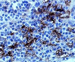 CD40 (human) monoclonal antibody (mAb 89) (Alexa Fluor® 488) Immunohistochemistry