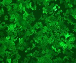 CD40 (human) monoclonal antibody (mAb 89) (biotin conjugate) Immunohistochemistry