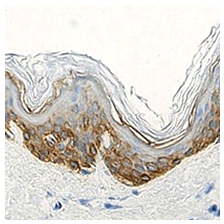 Cytokeratin 14 polyclonal antibody Immunohistochemistry