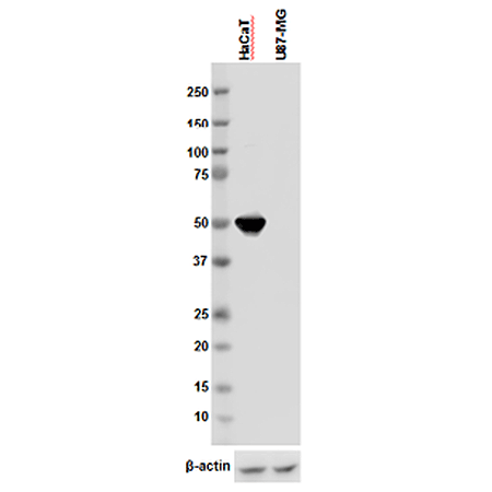 Cytokeratin 14 polyclonal antibody Western Blot
