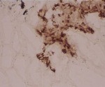 LAMP3 (human) monoclonal antibody (104G4) (Alexa Fluor® 546) Immunohistochemistry