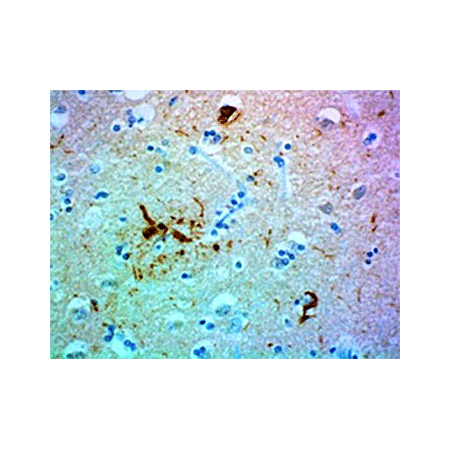 Tau (human) monoclonal antibody (Tau 12) Immunohistochemistry