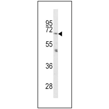 PC2 polyclonal antibody Western blot
