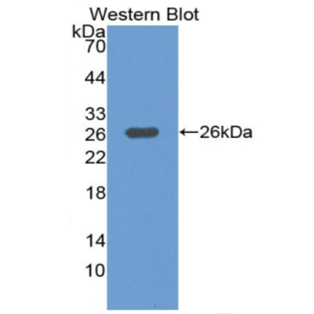 MEKK1 polyclonal antibody Western blot