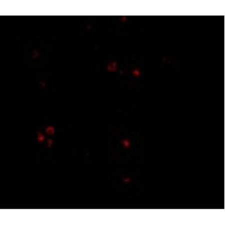 MDA5 polyclonal antibody Immunofluorescence