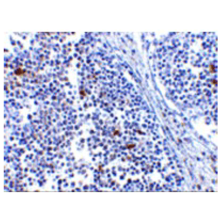 MDA5 polyclonal antibody Immunohistochemistry