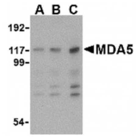 MDA5 polyclonal antibody Western blot