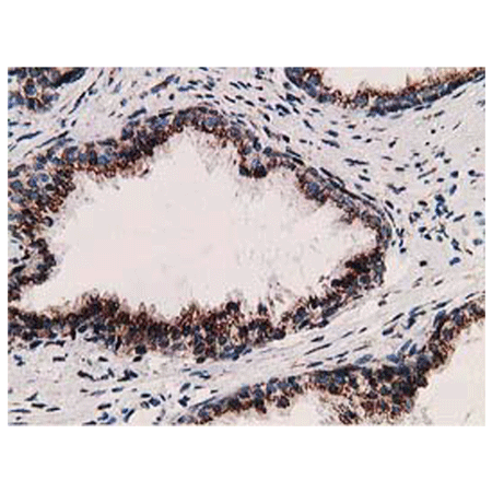 ERGIC-53 monoclonal antibody (OTI1A8) Immunohistochemistry