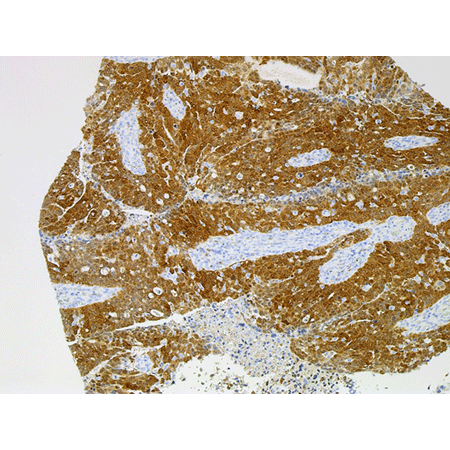 p16INK4a monoclonal antibody (Ready-to-Use) Immunohistochemistry