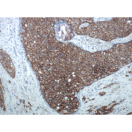 HER2/Neu monoclonal antibody 1