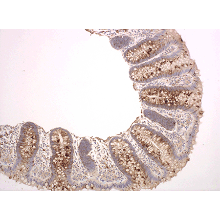 MUC1 Recombinant monoclonal antibody (HMFG2) (Rabbit IgGlambda) Immunohistochemistry